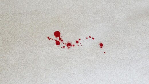 44. How to Get Out Blood Out of Carpet1
